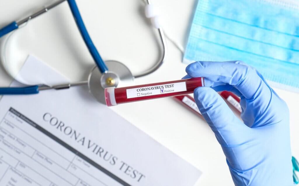 Nigeria records eight new coronavirus cases as toll hits 97
