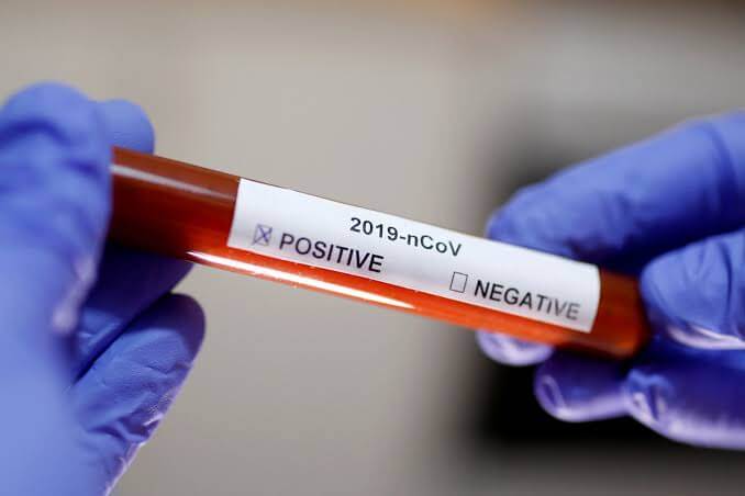  Nigeria records four new coronavirus cases