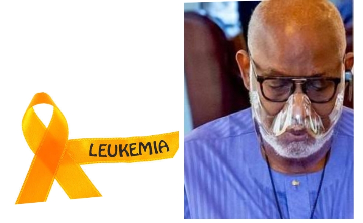  What to know about leukemia — the disease Akeredolu battled for months
