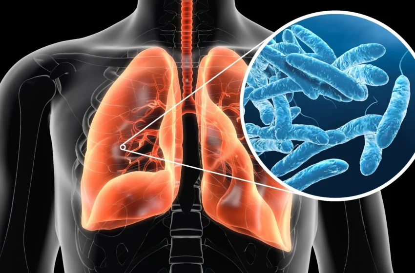  Legionnaires’ disease outbreak: What to know about precautions and symptoms