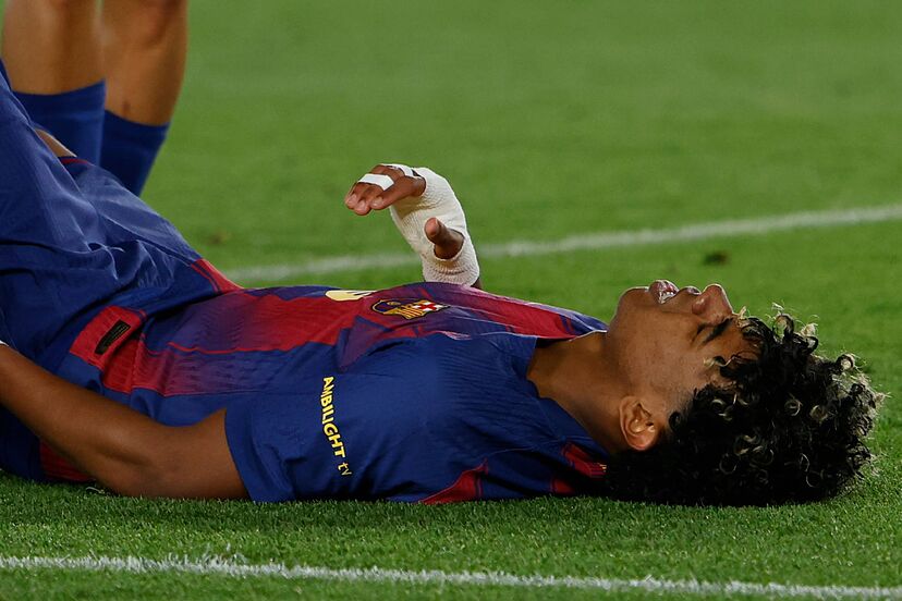  Lamine Yamal injury scare: Barcelona fear torn hamstring as World Cup dreams hang in the balance
